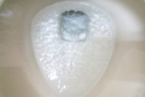 トイレの水位が低い原因は？対処法や注意点を解説